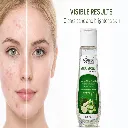 face wash  results.webp